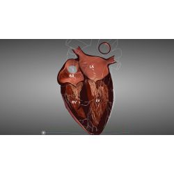 HeartWorks Modul eLearn – Einführungskurs transösophageale Echokardiographie 