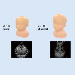 Kyoto Kagaku Neonatal Ultraschall-Kopfmodell, normal