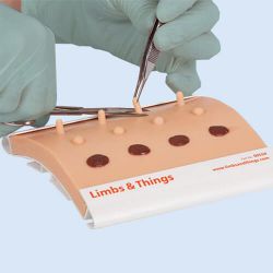 Limbs & Things Pad mit Nävus, Tags und seborrhoische Keratose (2 Stück)