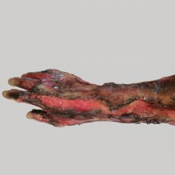 MedicFX – Überzug-Wundmodell „Unterarm mit Brandwunden“