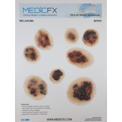 MedicFX – Set Wundmodelle „Melanome“