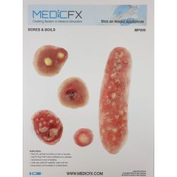 MedicFX – Set Wundmodelle „Furunkel und Beulen“