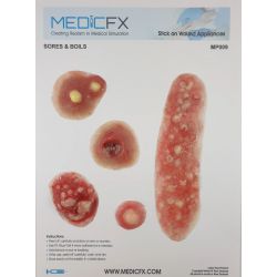 MP021 Post surgery stick on wounds - MedicFX