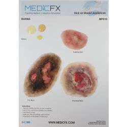 MedicFX – Set Wundmodelle „Verbrennungen“