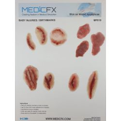 MedicFX – Set Wundmodelle „Geburtsmarken und Traumawunden“