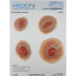 MedicFX – Set Wundmodelle „Kolostomie“
