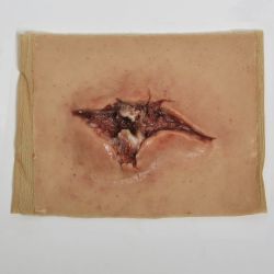 MedicFX – Überzug-Wundmodell „Offene Fraktur“