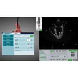 HeartWorks Modul 12 – optionales Upgrade Vermessung und Berechnung – TEE/TTE