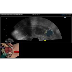 ScanTrainer „TVS/TAS-SimCenter - Modul 7a – Transvaginal-/Transabdominal-Ultraschall-Lernpaket für Simulationszentren mit 2 Trainingsstationen” – für ScanTrainer Standard