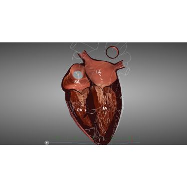 HeartWorks Modul eLearn – Einführungskurs transösophageale Echokardiographie 