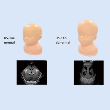 Kyoto Kagaku Neonatal Ultraschall-Kopfmodell, abnormal