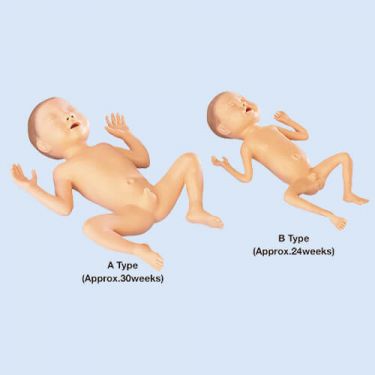 Koken – Frühgeborenes-Baby männlich, 30 Wochen