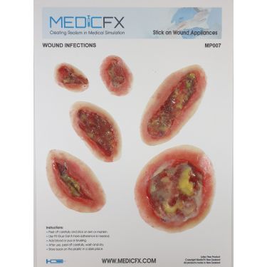 MedicFX – Set Wundmodelle „Infizierte Wunden“