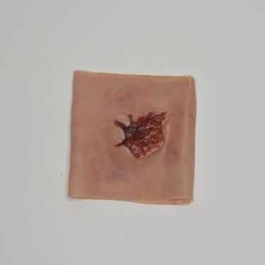 MedicFX – Überzug-Wundmodell „Schusswunde mit Ein- Und Austrittsverletzung“