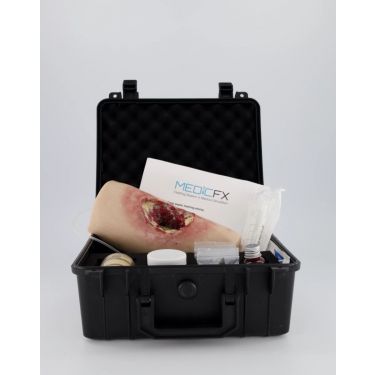MedicFX – Bein mit tiefer septischer Wunde - DeLuxe