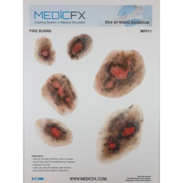 MedicFX – Set Wundmodelle „Brandwunden“