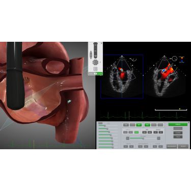 HeartWorks Modul 13 – optionales Upgrade Bi-Plane Doppelschnittfunktion – TEE/TTE