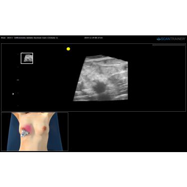 ScanTrainer „TAS-Examine - Modul 12 – Transabdomnial-Ultraschall-Training- Fortgeschrittene” – für ScanTrainer Standard