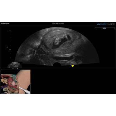 ScanTrainer „TVS-Notfall - Modul 1b – Transvaginal-Ultraschall-Notfall-Lernpaket” – für ScanTrainer Standard