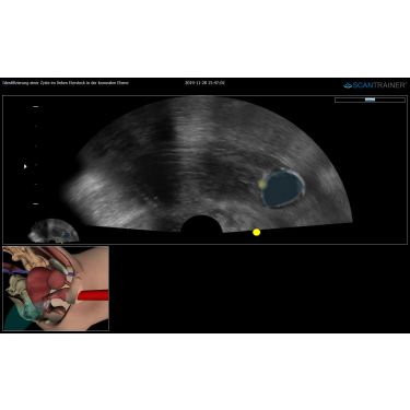 ScanTrainer „TVS/TAS-SimCenter - Modul 7a – Transvaginal-/Transabdominal-Ultraschall-Lernpaket für Simulationszentren mit 2 Trainingsstationen” – für ScanTrainer Standard