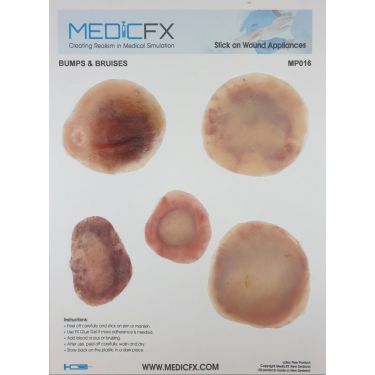 MedicFX – Set Wundmodelle „Beulen und Blutergüsse“