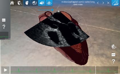 Neu :  HeartWorks AR - Version 2.0 