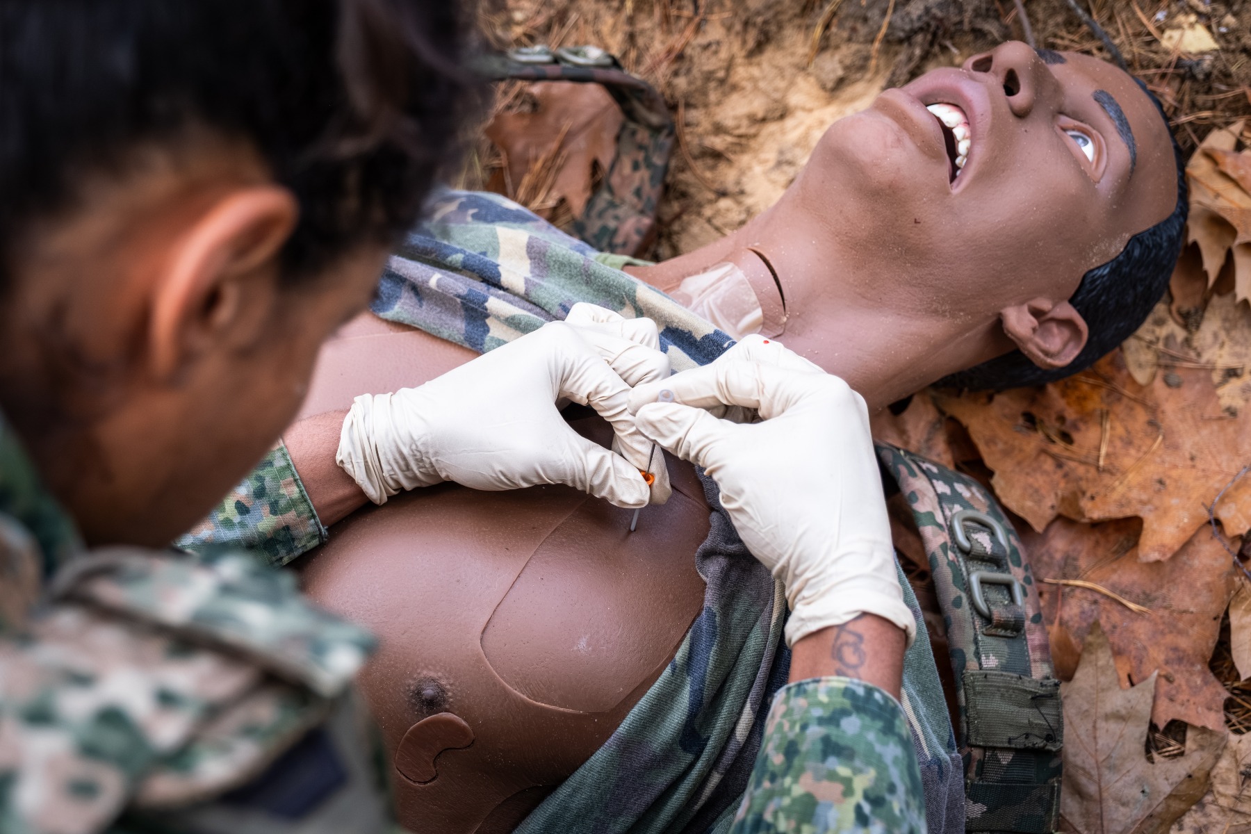 WOUND WOUND
